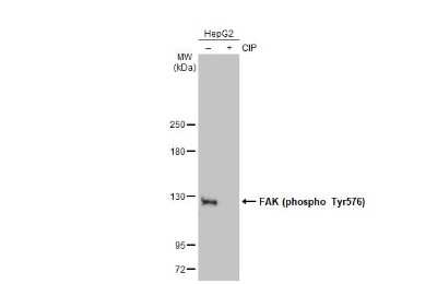Western Blot: FAK [p Tyr576] Antibody [NBP3-13071]